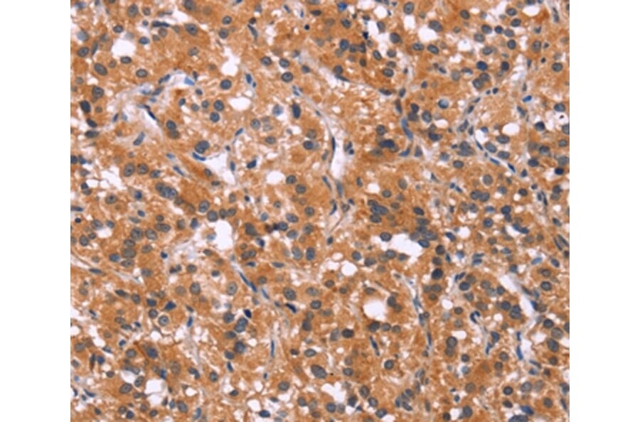 Immunohistochemistry - MAPK11 Antibody from Signalway Antibody (37131) - Antibodies.com