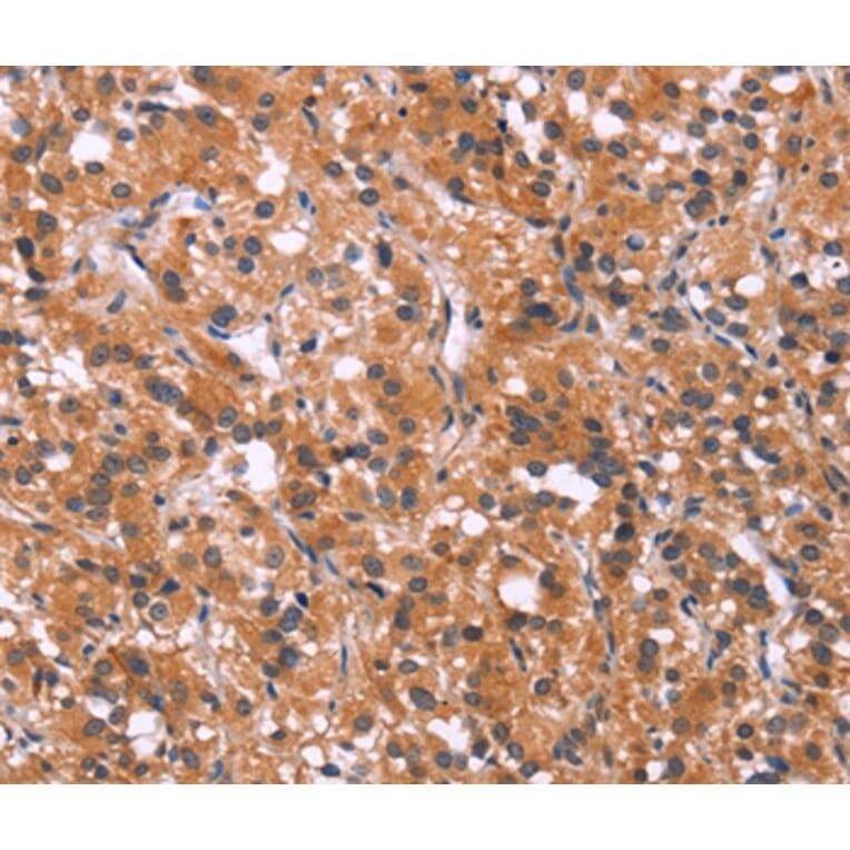 Immunohistochemistry - MAPK11 Antibody from Signalway Antibody (37131) - Antibodies.com