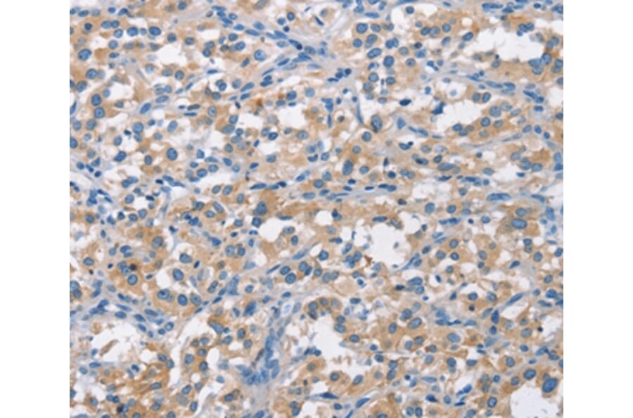Immunohistochemistry - CDC25B Antibody from Signalway Antibody (37166) - Antibodies.com