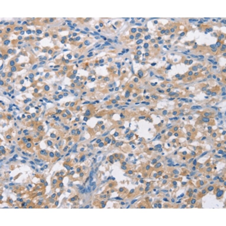 Immunohistochemistry - CDC25B Antibody from Signalway Antibody (37166) - Antibodies.com