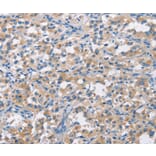 Immunohistochemistry - CDC25B Antibody from Signalway Antibody (37166) - Antibodies.com
