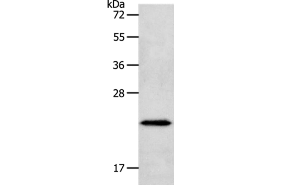NEUROG1 Antibody from Signalway Antibody (37184) - Antibodies.com