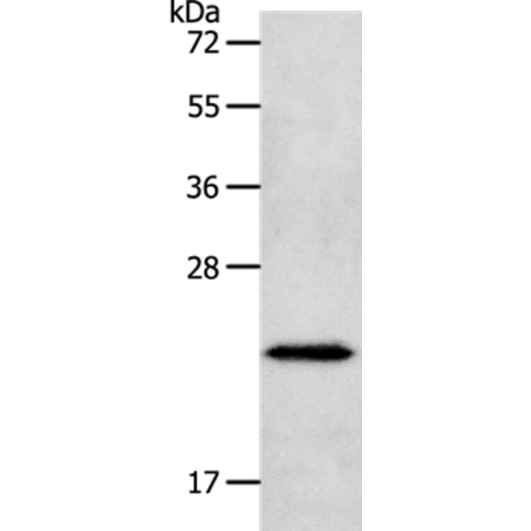 NEUROG1 Antibody from Signalway Antibody (37184) - Antibodies.com