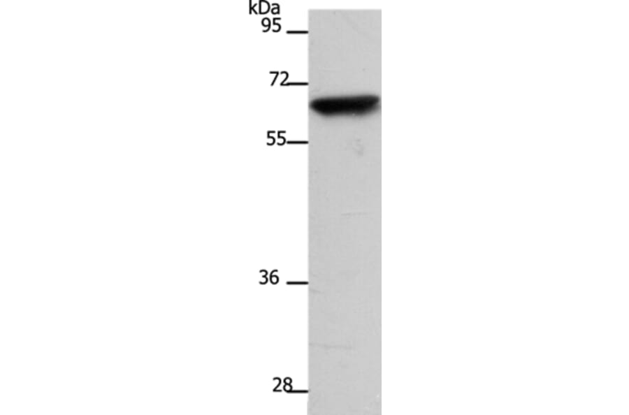 SLC22A8 Antibody from Signalway Antibody (37200) - Antibodies.com