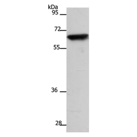 SLC22A8 Antibody from Signalway Antibody (37200) - Antibodies.com