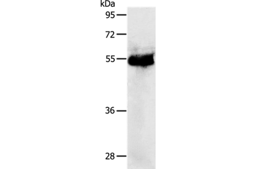 PRKAR1B Antibody from Signalway Antibody (37215) - Antibodies.com