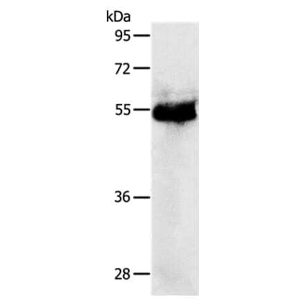 PRKAR1B Antibody from Signalway Antibody (37215) - Antibodies.com