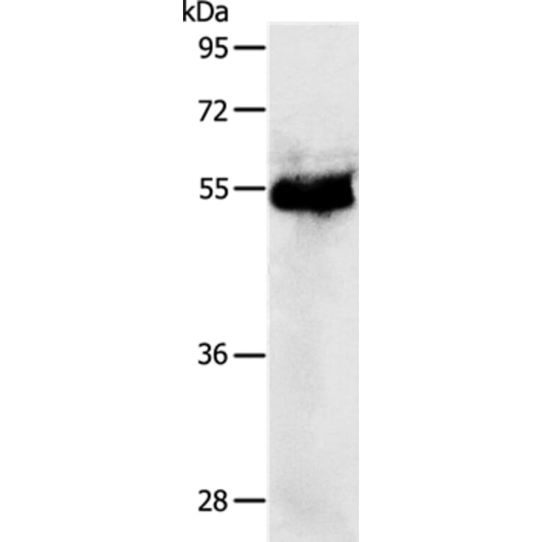 PRKAR1B Antibody from Signalway Antibody (37215) - Antibodies.com