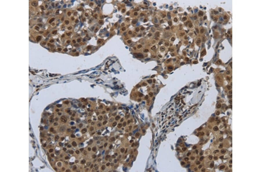 Immunohistochemistry - PRKAR1B Antibody from Signalway Antibody (37215) - Antibodies.com