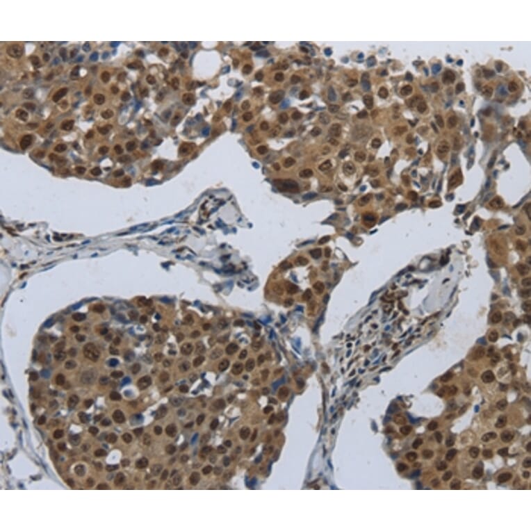 Immunohistochemistry - PRKAR1B Antibody from Signalway Antibody (37215) - Antibodies.com