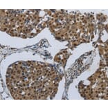 Immunohistochemistry - PRKAR1B Antibody from Signalway Antibody (37215) - Antibodies.com