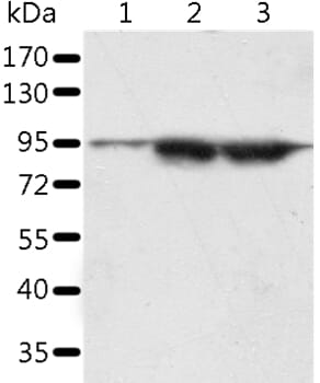 Gel: 10% SDS-PAGE Lysates (from left to right): A549 and lncap cell, human seminoma tissue Amount of lysate: 60ug per lane Primary antibody: 1/1000 dilution Secondary antibody dilution: 1/8000 Exposure time: 5 minutes