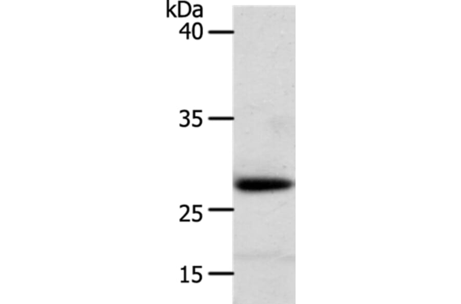 RARRES1 Antibody from Signalway Antibody (37279) - Antibodies.com