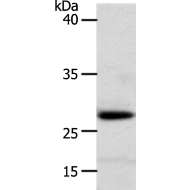RARRES1 Antibody from Signalway Antibody (37279) - Antibodies.com