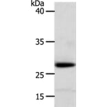 RARRES1 Antibody from Signalway Antibody (37279) - Antibodies.com