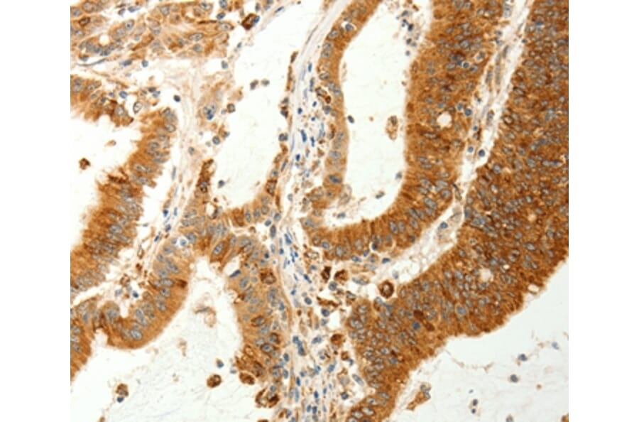 Immunohistochemistry - RARRES1 Antibody from Signalway Antibody (37279) - Antibodies.com