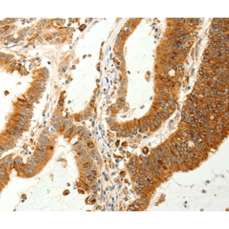 Immunohistochemistry - RARRES1 Antibody from Signalway Antibody (37279) - Antibodies.com