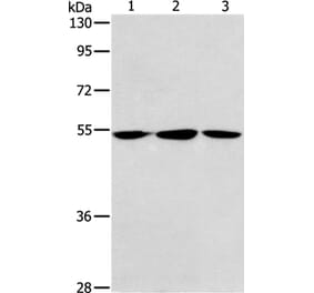 ALDH9A1 Antibody from Signalway Antibody (37325) - Antibodies.com
