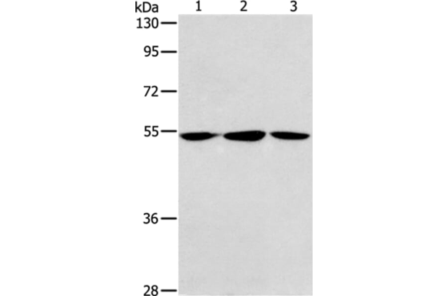 ALDH9A1 Antibody from Signalway Antibody (37325) - Antibodies.com