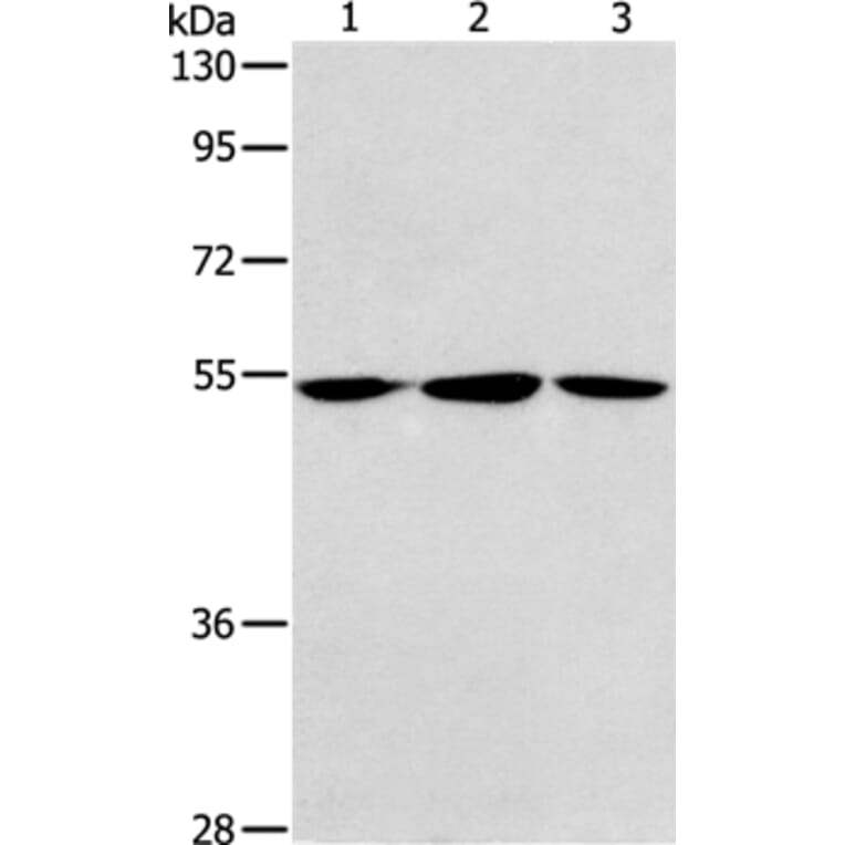 ALDH9A1 Antibody from Signalway Antibody (37325) - Antibodies.com