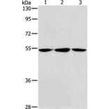 ALDH9A1 Antibody from Signalway Antibody (37325) - Antibodies.com