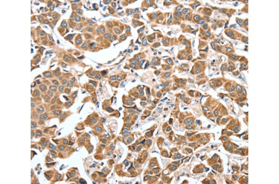Immunohistochemistry - ALDH9A1 Antibody from Signalway Antibody (37325) - Antibodies.com