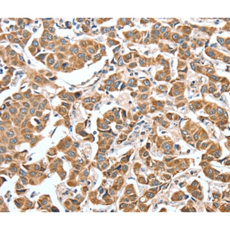 Immunohistochemistry - ALDH9A1 Antibody from Signalway Antibody (37325) - Antibodies.com
