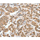 Immunohistochemistry - ALDH9A1 Antibody from Signalway Antibody (37325) - Antibodies.com