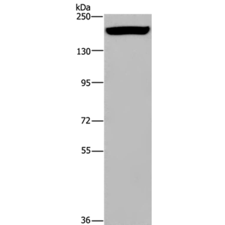ARFGEF2 Antibody from Signalway Antibody (37349) - Antibodies.com