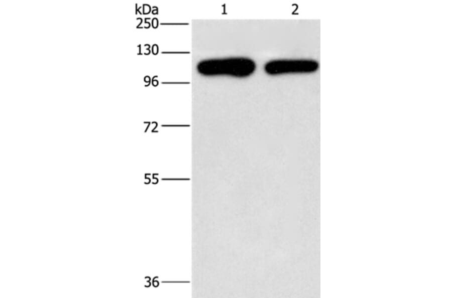 PIP5K1C Antibody from Signalway Antibody (37375) - Antibodies.com