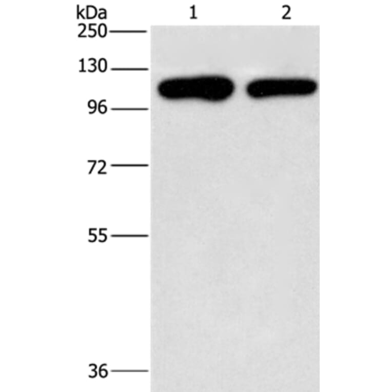 PIP5K1C Antibody from Signalway Antibody (37375) - Antibodies.com