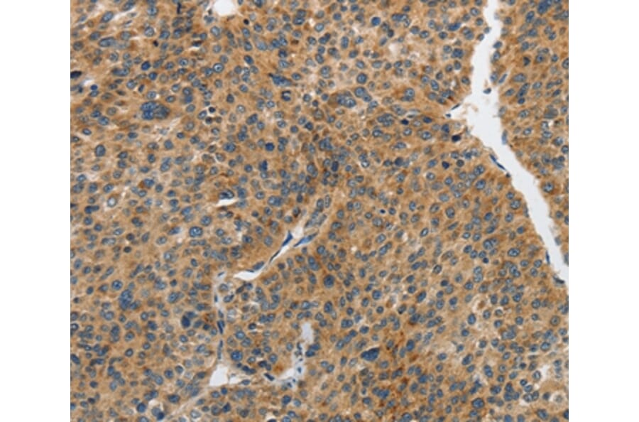 Immunohistochemistry - PIP5K1C Antibody from Signalway Antibody (37375) - Antibodies.com