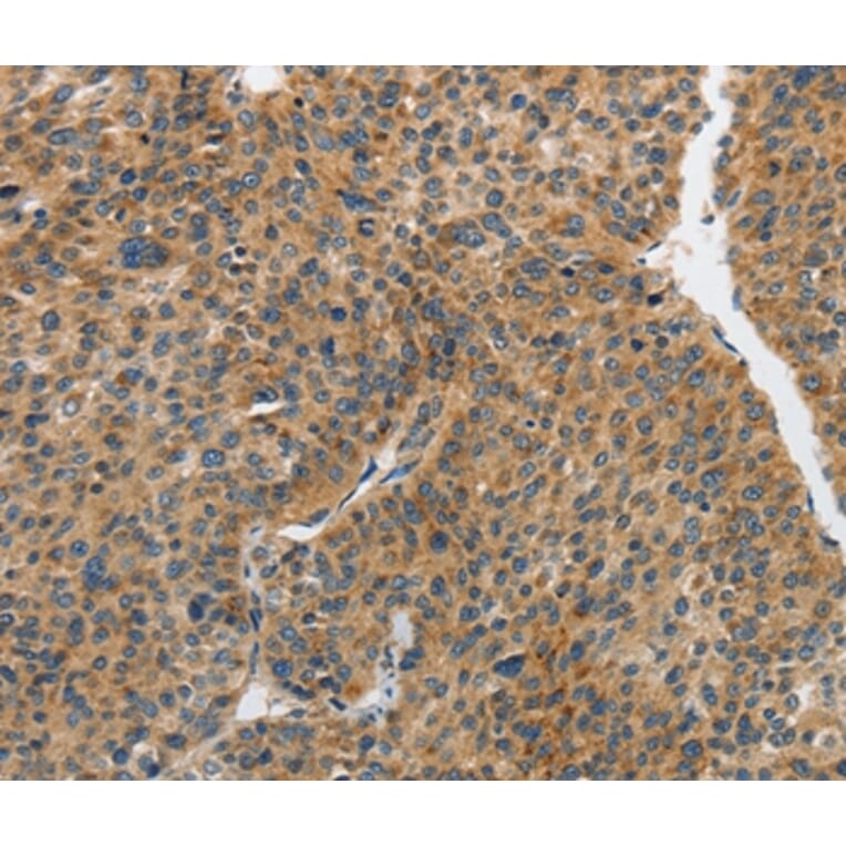 Immunohistochemistry - PIP5K1C Antibody from Signalway Antibody (37375) - Antibodies.com
