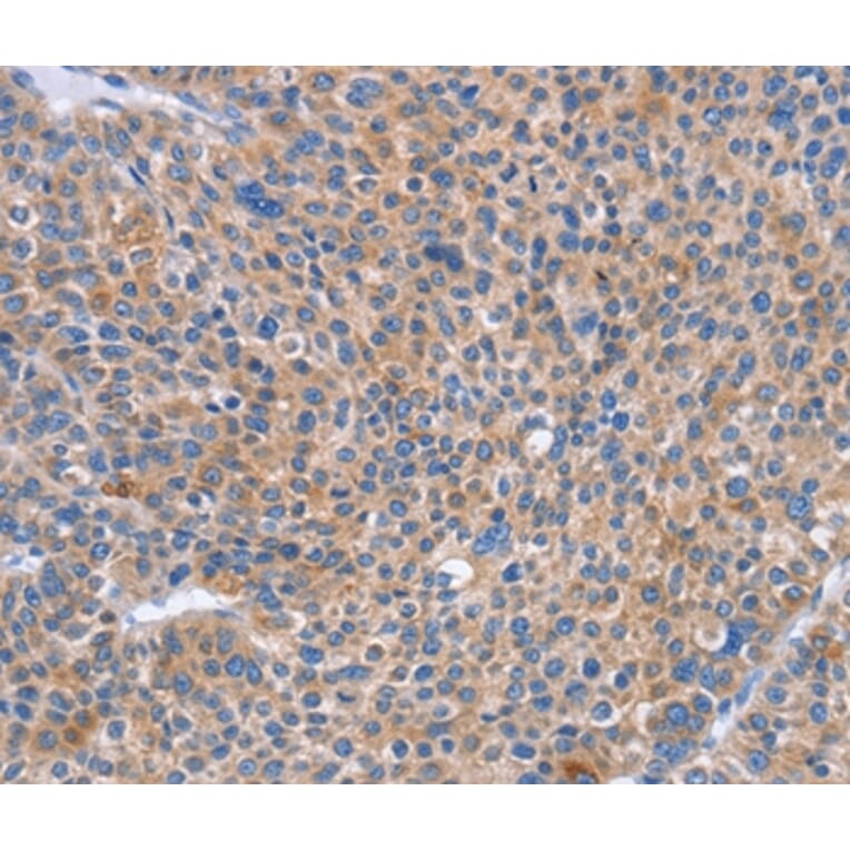 Immunohistochemistry - SIGLEC7 Antibody from Signalway Antibody (37470) - Antibodies.com