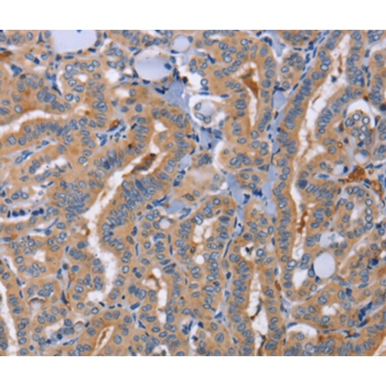 Immunohistochemistry - SIGLEC6 Antibody from Signalway Antibody (37473) - Antibodies.com
