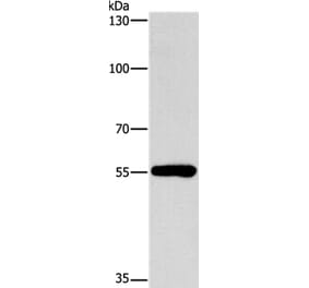 CYP46A1 Antibody from Signalway Antibody (37515) - Antibodies.com