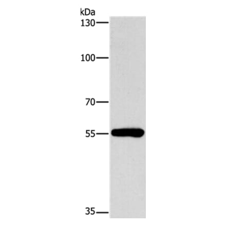 CYP46A1 Antibody from Signalway Antibody (37515) - Antibodies.com