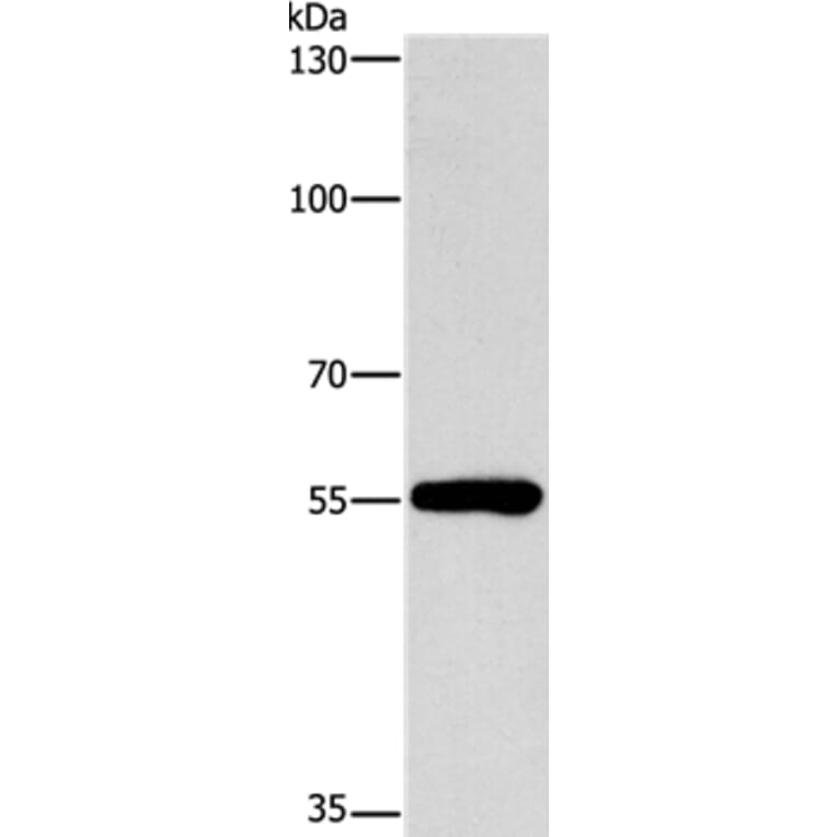 CYP46A1 Antibody from Signalway Antibody (37515) - Antibodies.com