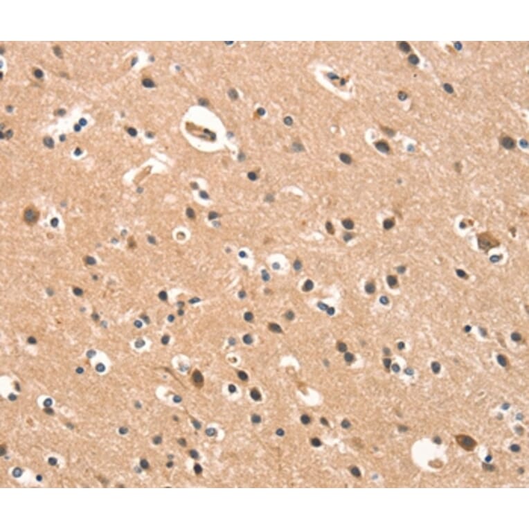 Immunohistochemistry - CYP46A1 Antibody from Signalway Antibody (37515) - Antibodies.com
