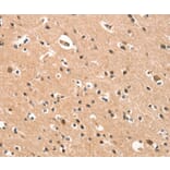Immunohistochemistry - CYP46A1 Antibody from Signalway Antibody (37515) - Antibodies.com