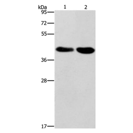 STK17A Antibody from Signalway Antibody (37538) - Antibodies.com