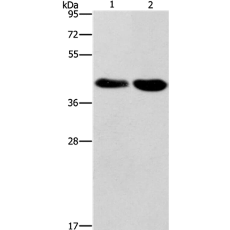 STK17A Antibody from Signalway Antibody (37538) - Antibodies.com