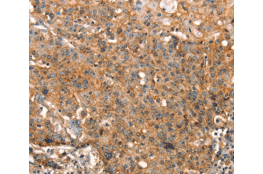 Immunohistochemistry - STK17A Antibody from Signalway Antibody (37538) - Antibodies.com