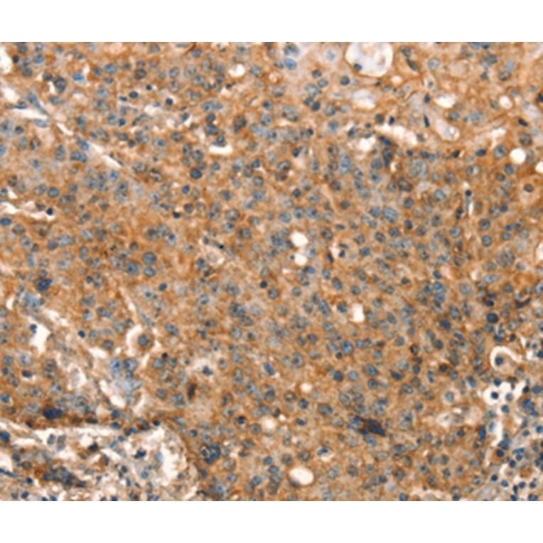 Immunohistochemistry - STK17A Antibody from Signalway Antibody (37538) - Antibodies.com