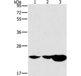 HRASLS2 Antibody from Signalway Antibody (37629) - Antibodies.com