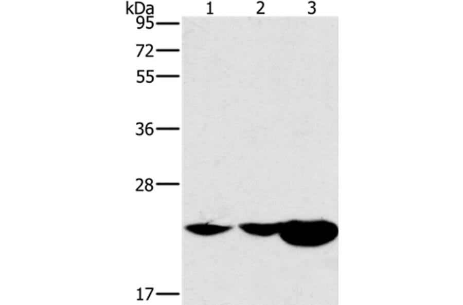 HRASLS2 Antibody from Signalway Antibody (37629) - Antibodies.com