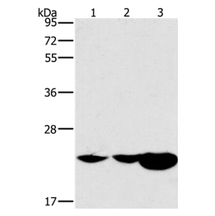 HRASLS2 Antibody from Signalway Antibody (37629) - Antibodies.com