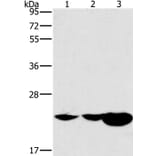 HRASLS2 Antibody from Signalway Antibody (37629) - Antibodies.com