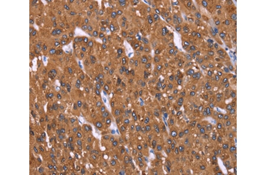 Immunohistochemistry - HRASLS2 Antibody from Signalway Antibody (37629) - Antibodies.com