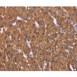 Immunohistochemistry - HRASLS2 Antibody from Signalway Antibody (37629) - Antibodies.com
